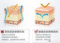 什么是皮肤屏障受损，你真的了解皮肤屏障吗？