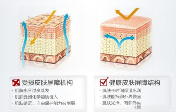 什么是皮肤屏障受损，你真的了解皮肤屏障吗？