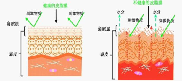 朵嘉浓和薇诺娜哪个好朵嘉浓什么是皮脂膜？